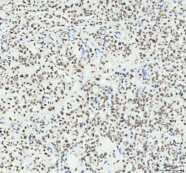 IHC - Anti-HNRNPM Rabbit Monoclonal Antibody ABO16441